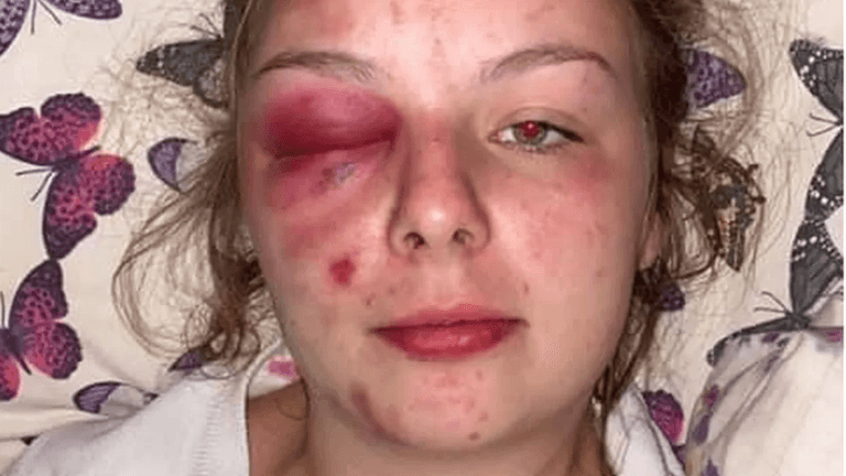 Eleanor Williams: Woman jailed over false rape claims Eleanor Williams: Woman jailed over false rape claims