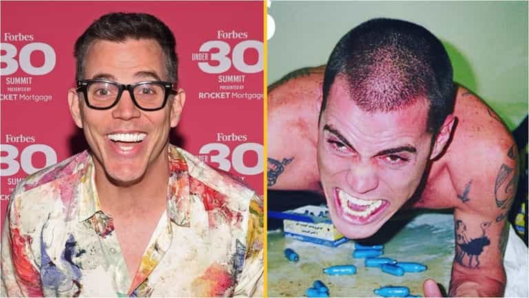 Steve-O celebrated sobriety milestone with before-and-after photos Steve-O celebrated sobriety milestone with before-and-after photos