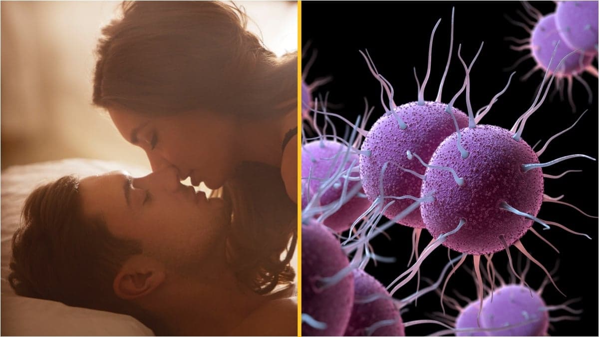 Experts warn STI ‘can be spread by kissing’ and ‘guidance should be changed’