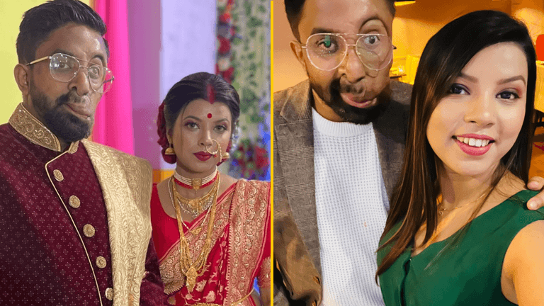 ‘My partner feared he’d never meet someone due to his facial disfigurement – but it was love at first sight’ ‘My partner feared he’d never meet someone due to his facial disfigurement – but it was love at first sight’