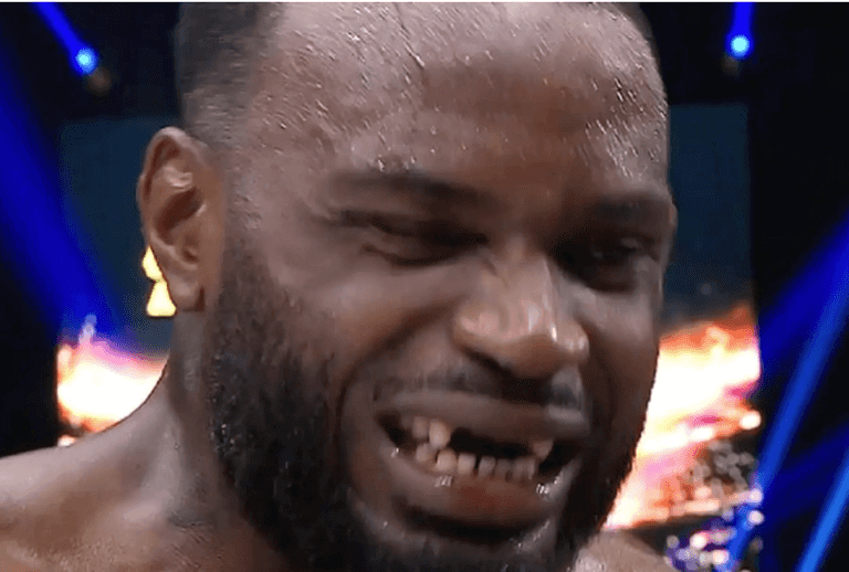 Kickboxer loses row of front teeth in horror incident during fight Kickboxer loses row of front teeth in horror incident during fight