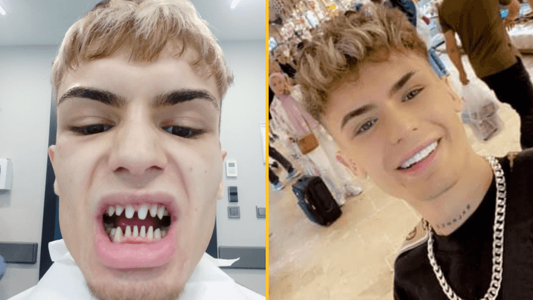 Man’s warning after Turkey teeth surgery leaves him looking ‘like a shark’ Man’s warning after Turkey teeth surgery leaves him looking ‘like a shark’