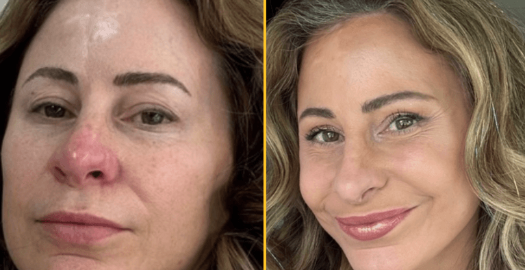 Kelly sold her house to pay for ’20 years younger’ facelift