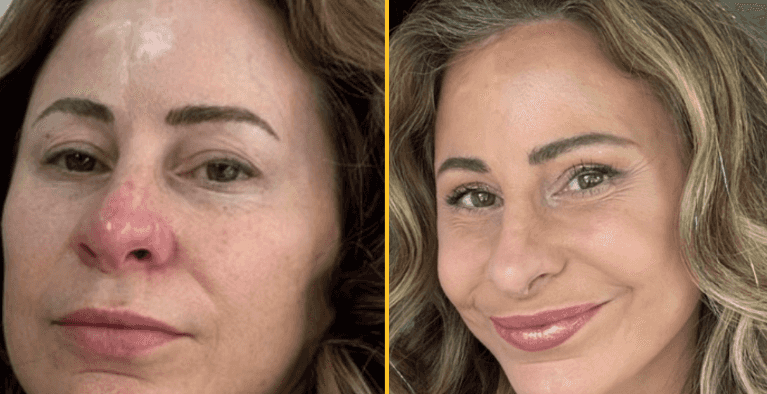 Kelly sold her house to pay for ’20 years younger’ facelift Kelly sold her house to pay for ’20 years younger’ facelift