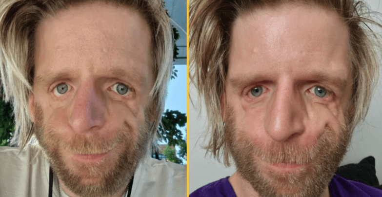 “My parents dumped me 36 hours after I was born and rejected me again in my 20s”