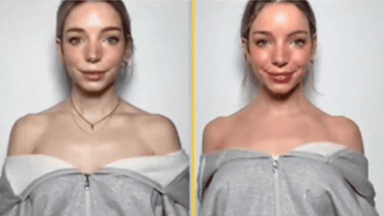 People are getting ‘Barbie botox’ for a ‘longer, more doll-like neck’ following success of movie People are getting ‘Barbie botox’ for a ‘longer, more doll-like neck’ following success of movie
