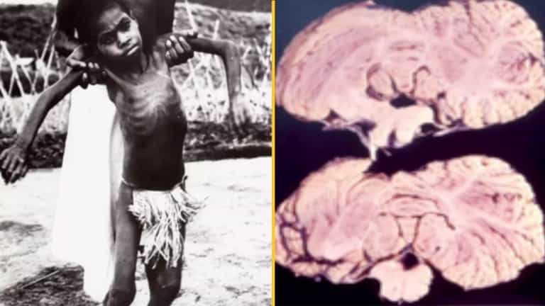 World’s most deadly disease has fatality rate of almost 100% World’s most deadly disease has fatality rate of almost 100%