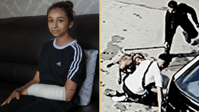 Girl, 11, attacked by XL bully in Birmingham says the dog should be put down and its owner jailed Girl, 11, attacked by XL bully in Birmingham says the dog should be put down and its owner jailed