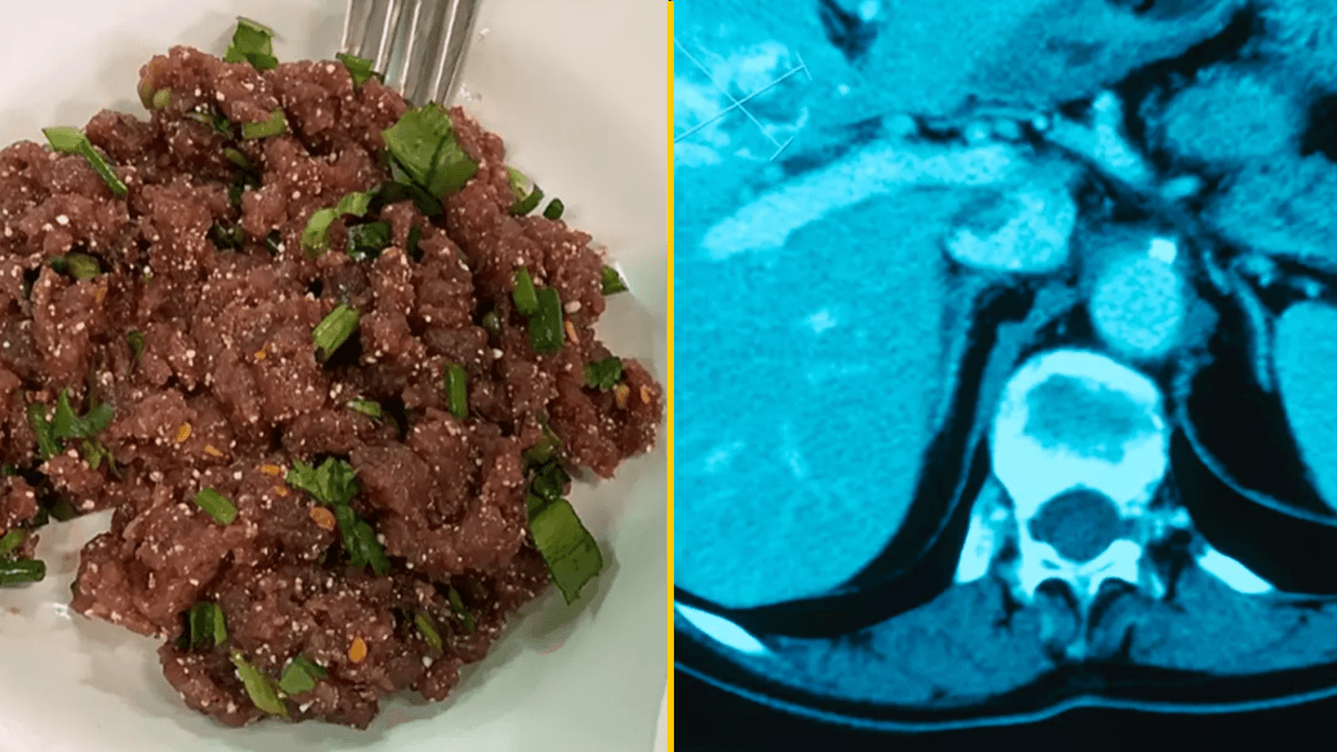 Single bite of Thai dish can give you liver cancer