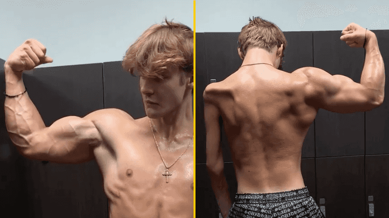 Lad praised for sharing why his right arm is much bigger than his left Lad praised for sharing why his right arm is much bigger than his left