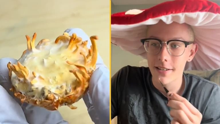 People fear The Last Of Us will happen after man grows zombie fungus from his skin and eats it People fear The Last Of Us will happen after man grows zombie fungus from his skin and eats it