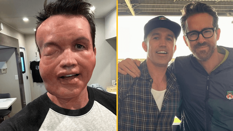 Rob McElhenney sparks concern with New Year’s Eve ‘allergic reaction’ pic Rob McElhenney sparks concern with New Year’s Eve ‘allergic reaction’ pic