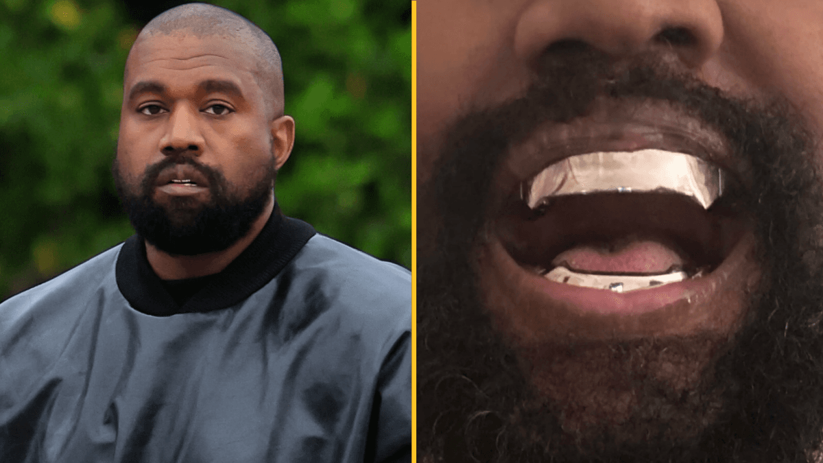 Kanye West’s £670,000 titanium dentures are ‘permanent’ and ‘go beyond veneers or grills’