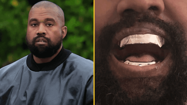 Kanye West’s £670,000 titanium dentures are ‘permanent’ and ‘go beyond veneers or grills’ Kanye West’s £670,000 titanium dentures are ‘permanent’ and ‘go beyond veneers or grills’