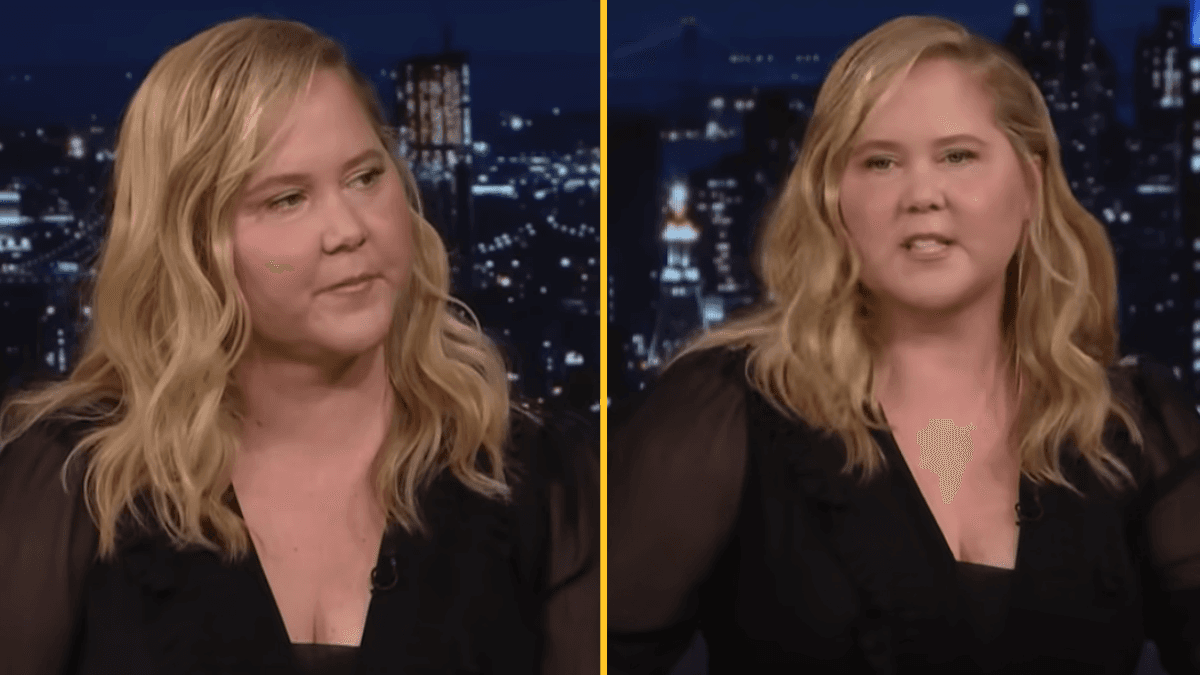 Amy Schumer responds to comments about her ‘puffy’ face