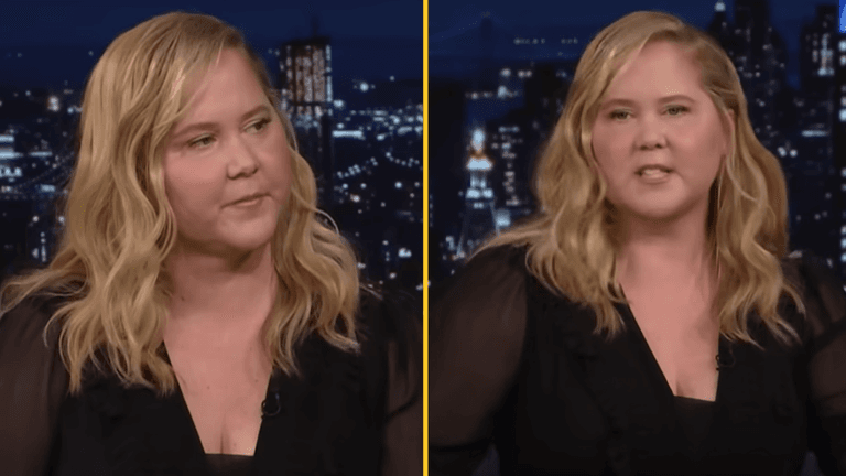 Amy Schumer responds to comments about her ‘puffy’ face Amy Schumer responds to comments about her ‘puffy’ face