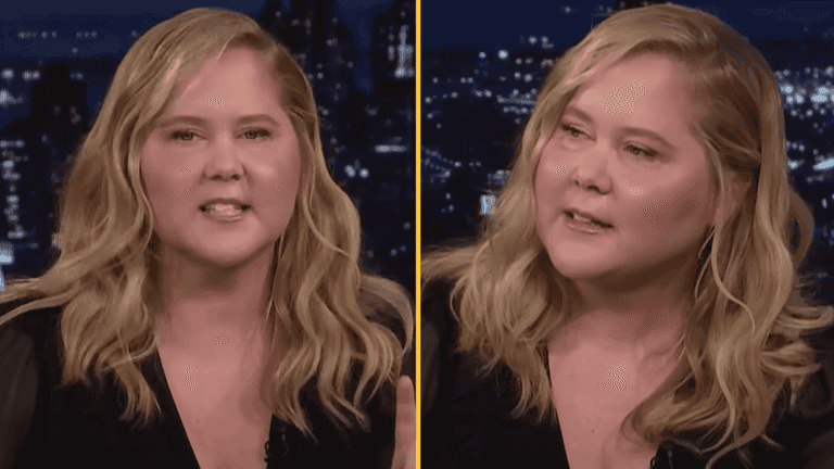 Amy Schumer reveals shock diagnosis after people mocked her ‘puffy’ face Amy Schumer reveals shock diagnosis after people mocked her ‘puffy’ face