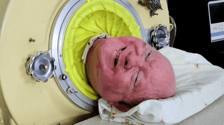 Man who lived inside iron lung for 70 years dies aged 78 Man who lived inside iron lung for 70 years dies aged 78