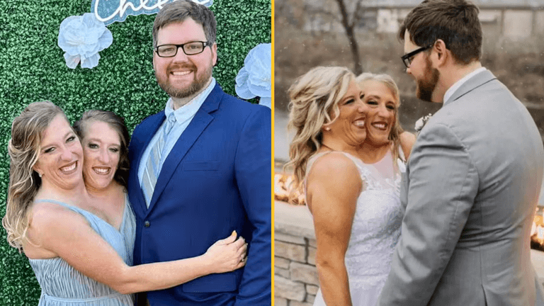 Conjoined twins Brittany and Abby Hensel break silence after ‘loud’ response to marriage news Conjoined twins Brittany and Abby Hensel break silence after ‘loud’ response to marriage news