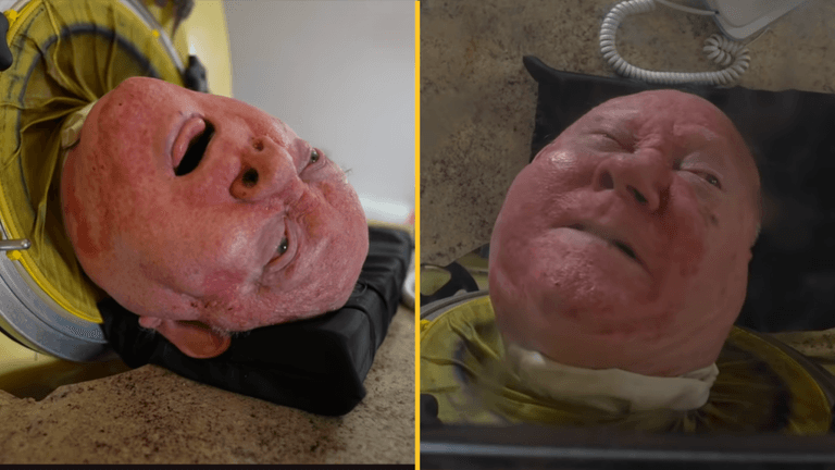 Iron lung man’s brother pays heartbreaking tribute after his death Iron lung man’s brother pays heartbreaking tribute after his death