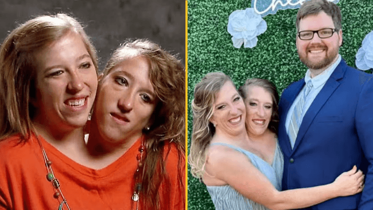 Everyone is asking the same question after conjoined twin Abby Hensel got married Everyone is asking the same question after conjoined twin Abby Hensel got married