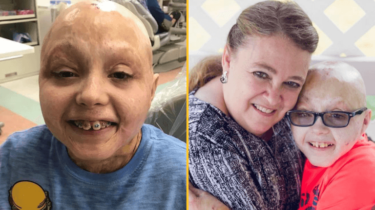 Two-year-old with ‘0 per cent chance of survival’ after burning 98 per cent of his body is now inspiring others Two-year-old with ‘0 per cent chance of survival’ after burning 98 per cent of his body is now inspiring others