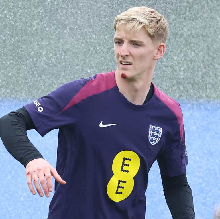 Anthony Gordon got ‘brakes mixed up’ as he shows off injuries following e-bike crash Anthony Gordon got ‘brakes mixed up’ as he shows off injuries following e-bike crash