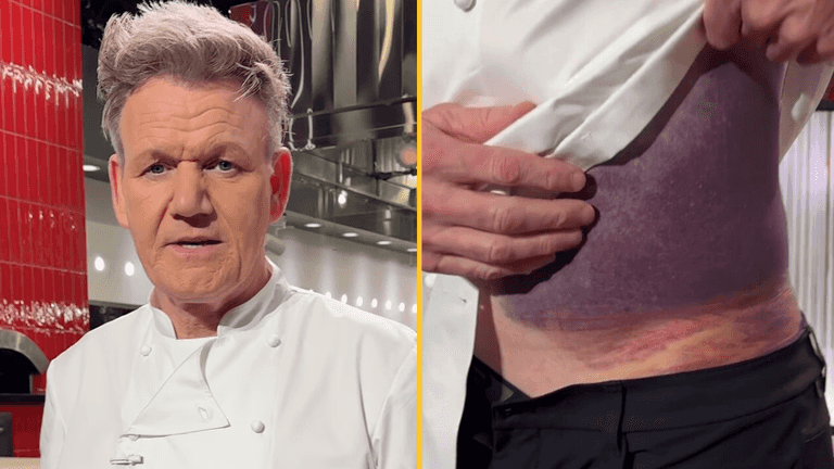 Gordon Ramsay says he’s ‘lucky to be alive’ after serious accident Gordon Ramsay says he’s ‘lucky to be alive’ after serious accident