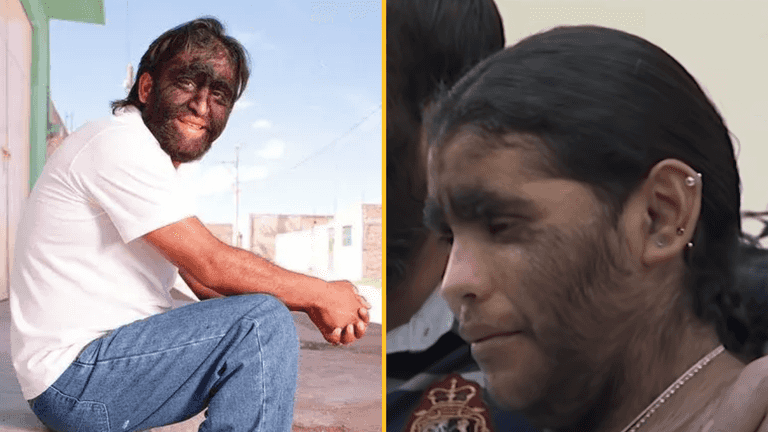 People rush to defend world’s hairiest family as trolls brand them with cruel nickname People rush to defend world’s hairiest family as trolls brand them with cruel nickname