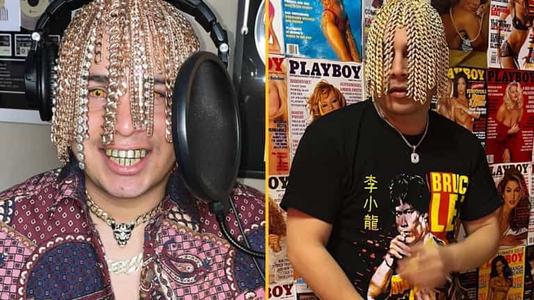 Rapper gets gold chain hooks surgically implanted into his head Rapper gets gold chain hooks surgically implanted into his head