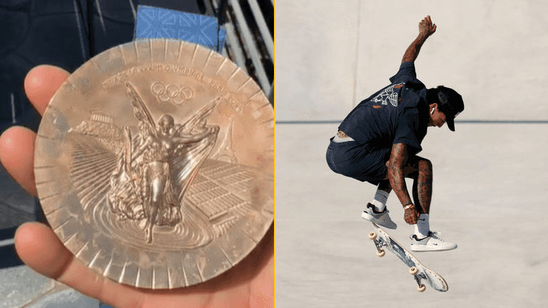 Olympian shares awful state of medal just a week after winning it Olympian shares awful state of medal just a week after winning it