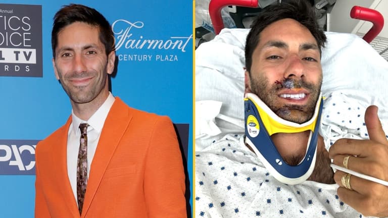Catfish star Nev Schulman breaks neck in horror crash Catfish star Nev Schulman breaks neck in horror crash