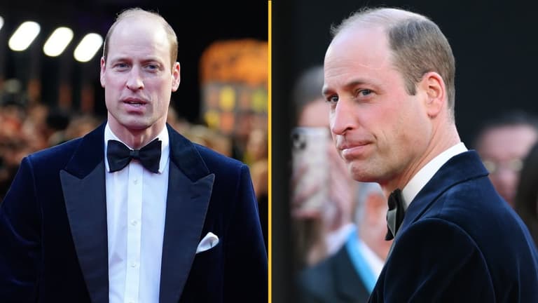 Prince William named sexiest bald man of 2024 Prince William named sexiest bald man of 2024