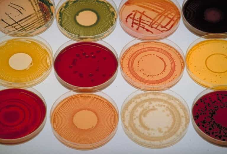 Scientists warn ‘mirror life’ bacteria could pose a serious threat to life on earth Scientists warn ‘mirror life’ bacteria could pose a serious threat to life on earth