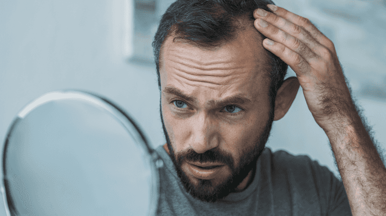 Doctors warn that common drink loved by millions may cause hair loss Doctors warn that common drink loved by millions may cause hair loss
