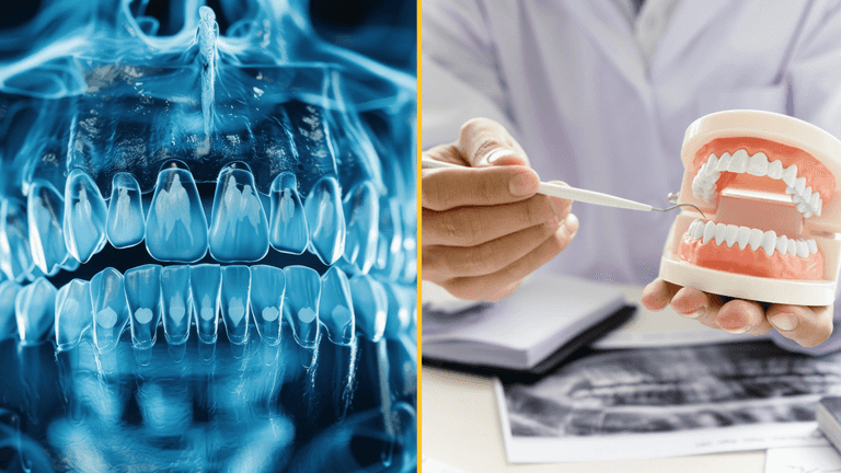 Cause of Alzheimer’s might be coming from inside your mouth, scientists find Cause of Alzheimer’s might be coming from inside your mouth, scientists find