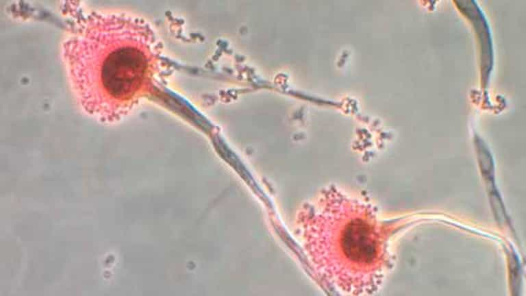 Warnings issued over killer ‘Last of Us’ fungus set to hit UK Warnings issued over killer ‘Last of Us’ fungus set to hit UK