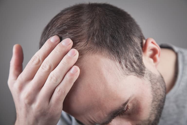 Male pattern baldness may soon be cured thanks to new drug Male pattern baldness may soon be cured thanks to new drug