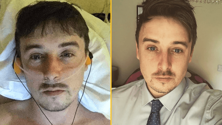 Man becomes father after having four inches of penis amputated Man becomes father after having four inches of penis amputated