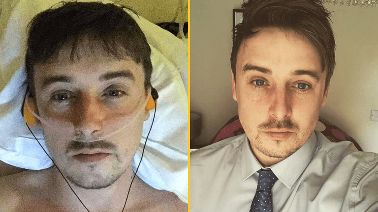 Man becomes father after having four inches of penis amputated Man becomes father after having four inches of penis amputated