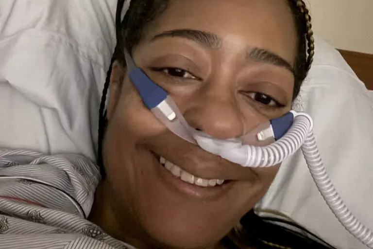 Woman lost both legs just weeks after developing a minor cough at a wedding Woman lost both legs just weeks after developing a minor cough at a wedding