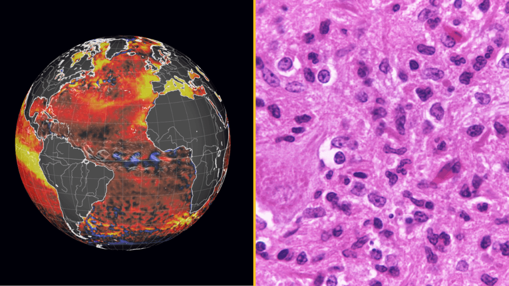 Super El Niño now comes with fatal rabies warning after ‘significant global shift’