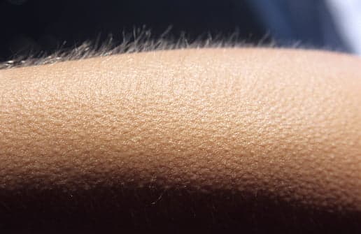 Why do we get goosebumps and where do they come from?