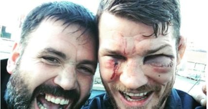 Michael Bisping may be medically suspended until next April due to injuries picked up at UFC 204