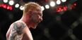 UFC star’s injury is so gruesome he felt compelled to apologise over it