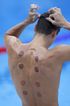 What are the dark circles on swimmers’ backs at Paris Olympics