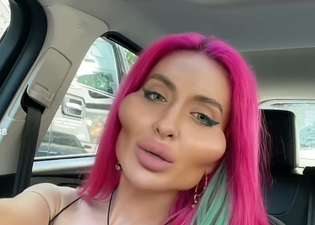 Model with ‘world’s biggest cheeks’ shows what she looked like at 16 – before transformation