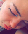 Woman goes blind and cries blue tears after having eyeballs tattooed