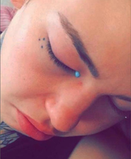 Woman goes blind and cries blue tears after having eyeballs tattooed
