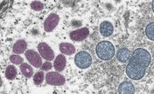 Gay and bisexual men to be offered monkeypox vaccine